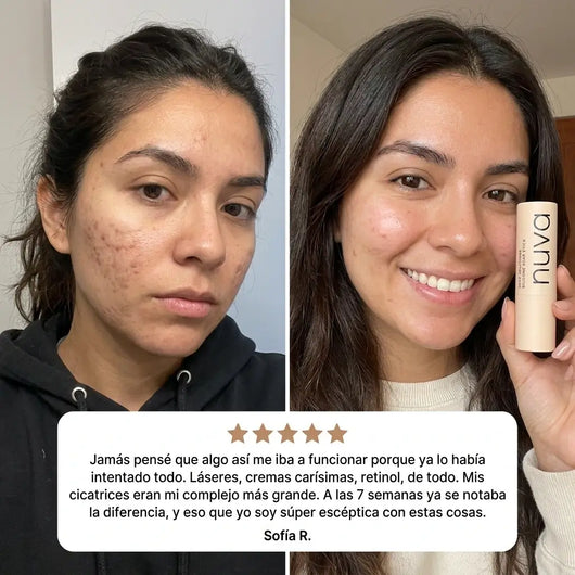 Nuva Stick: Reparador de Cicatrices