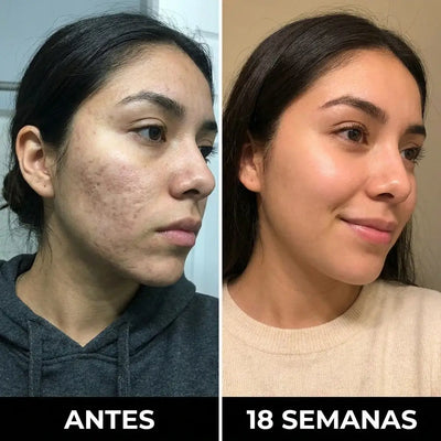 Nuva Stick: Reparador de Cicatrices